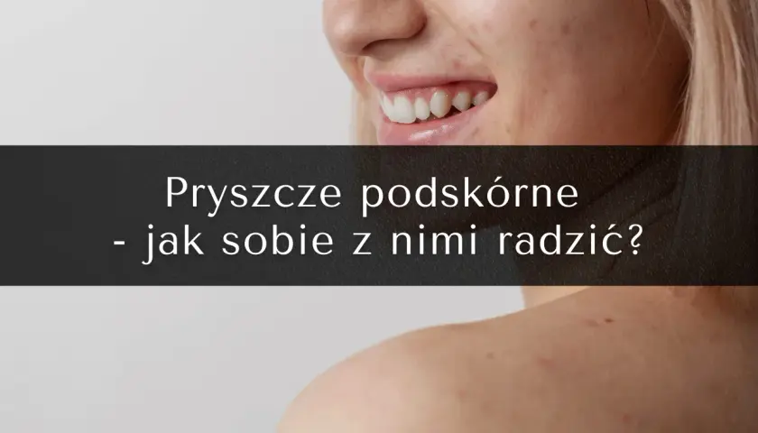 Jak pozbyć się pryszcza podskórnego? Sprawdzone metody i porady